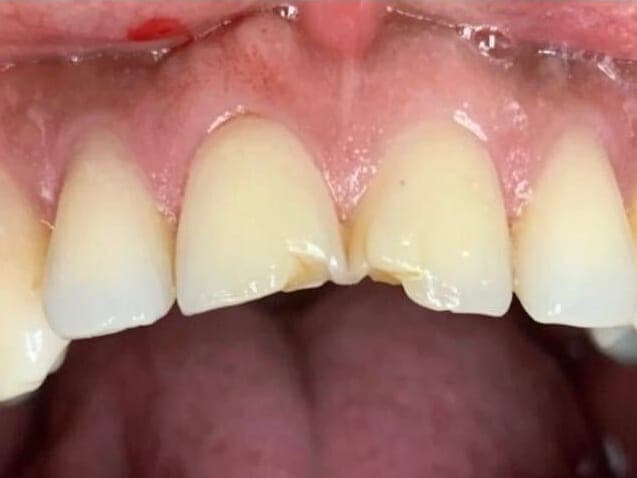 Case 9, before treatment at Johns Creek Family Dentistry