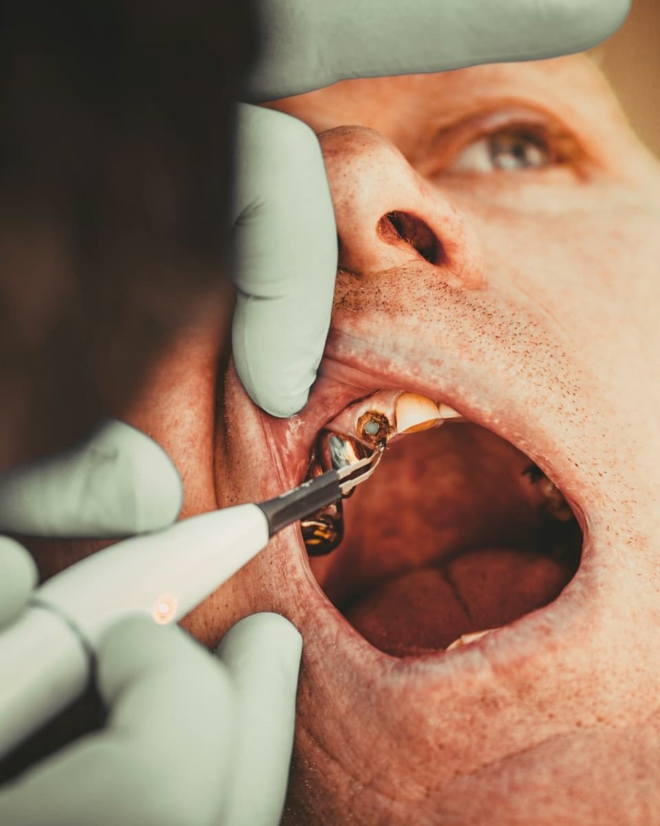 A gloved dentist examining a patient's gums with a periodontal probe